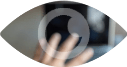 blurry vision - a potential sign of glaucoma