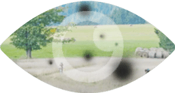 dark spots - early signs of diabetic retinopathy