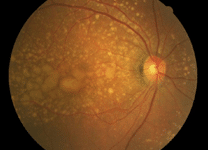 dry amd img 1 dry amd img 1