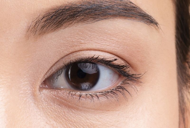 double-eyelid