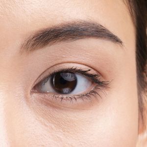 double-eyelid