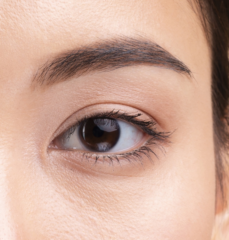 double-eyelid