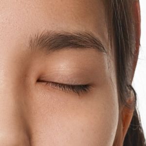 eyelid