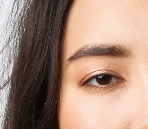 droopy eyelids