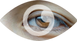 Droopy Eyelids Services - Icon