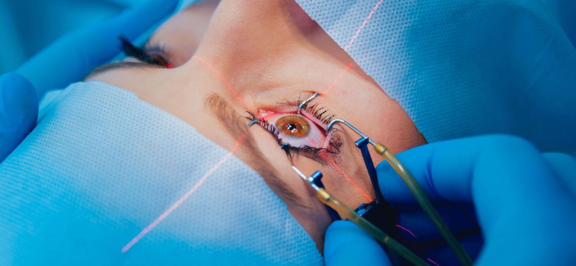 Patient undergoing cataract surgery for high myopia in Singapore - Eye Max Centre