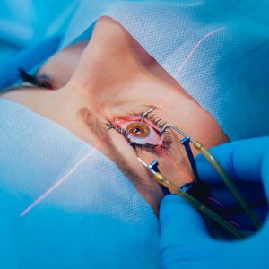 Patient undergoing cataract surgery for high myopia in Singapore - Eye Max Centre