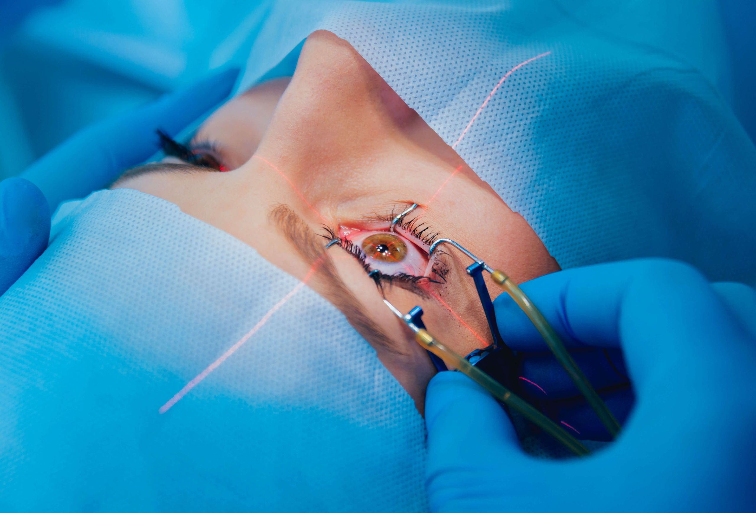 Patient undergoing cataract surgery for high myopia Patient undergoing cataract surgery for high myopia in Singapore - Eye Max Centre