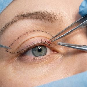 Droopy eyelid (ptosis) correction surgery with surgical instruments for medical or cosmetic reasons - Eye Max Centre